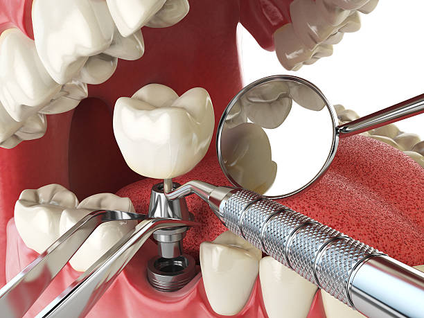 Best Weekend Emergency Dentist in Rockwell, AR