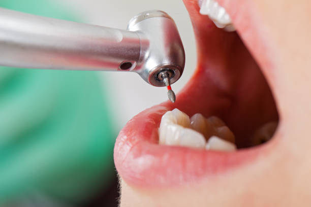 Best After-Hours Emergency Dentist in Rockwell, AR